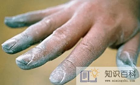 得了灰指甲要不要紧1