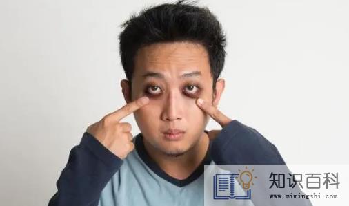 黑眼圈很重怎么去除1