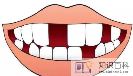 牙结石掉了牙龈空了牙齿会不会掉2